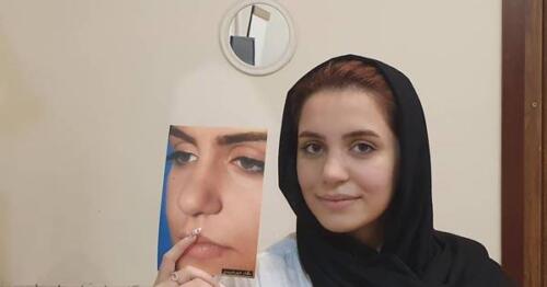 عمل-بینی-428
