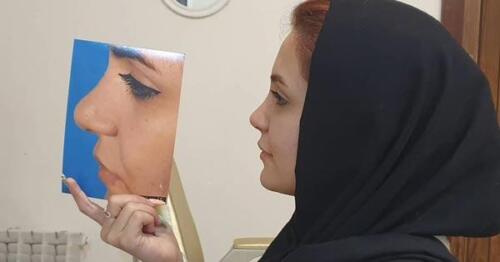 عمل-بینی-432