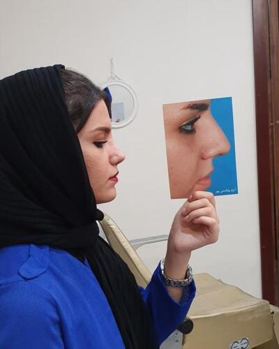 عمل-بینی-450