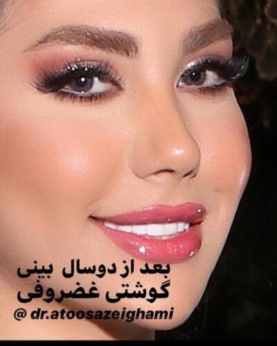 عمل-بینی-457
