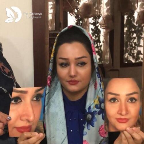 عمل-بینی-477