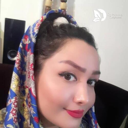 عمل-بینی-479