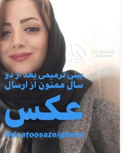 عمل-بینی-481