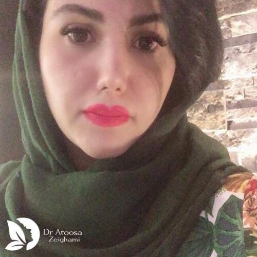 عمل-بینی-492