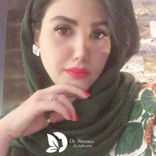 عمل-بینی-493