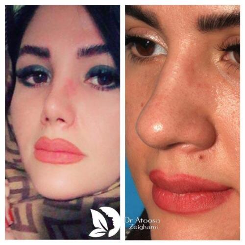 عمل-بینی-495