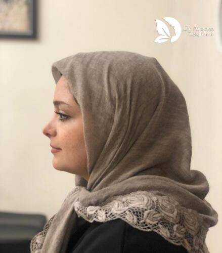 عمل-بینی-518