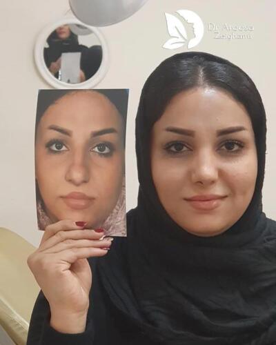 عمل-بینی-532