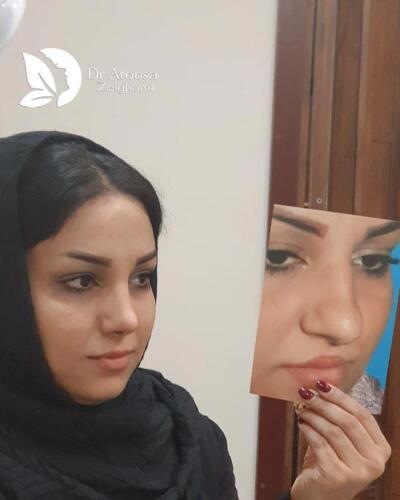 عمل-بینی-533