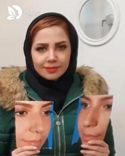 عمل-بینی-552