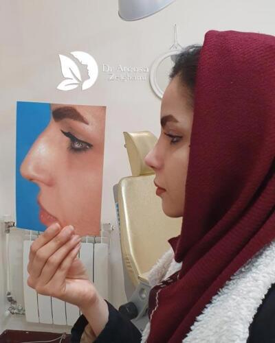 عمل-بینی-553