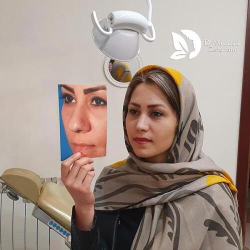 عمل-بینی-558