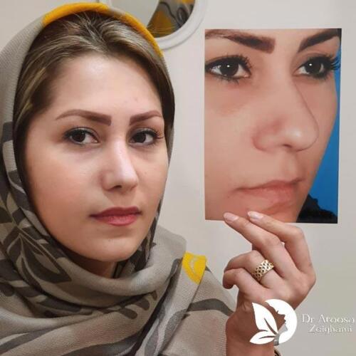 عمل-بینی-559