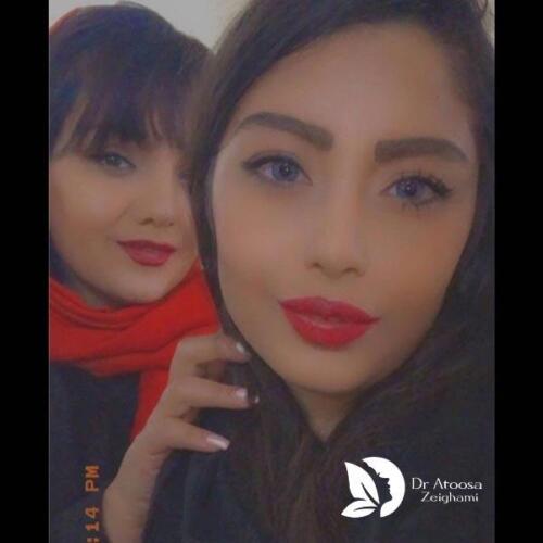عمل-بینی-566
