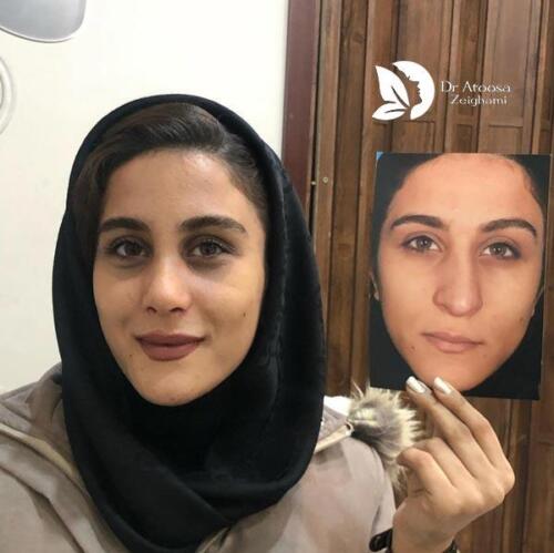 عمل-بینی-577