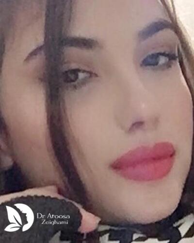 عمل-بینی-582