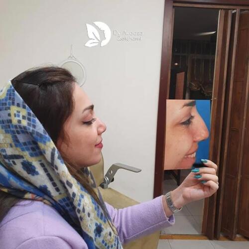 عمل-بینی-588