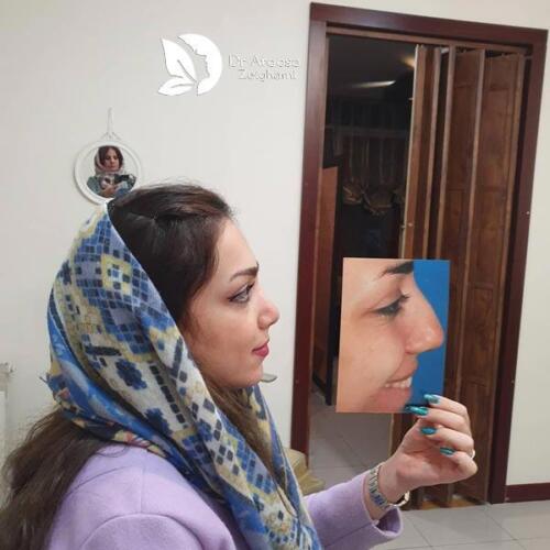 عمل-بینی-589