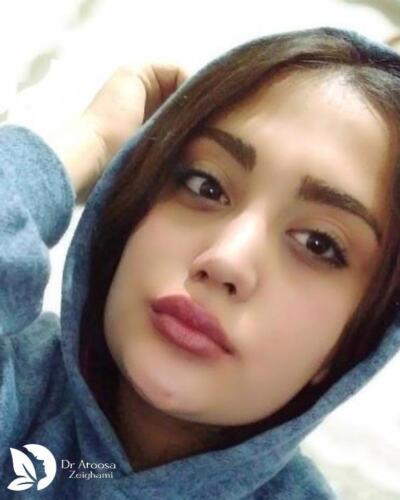 عمل-بینی-598