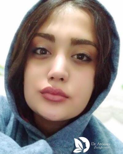 عمل-بینی-599