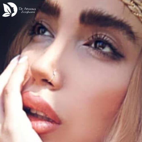 عمل-بینی-604