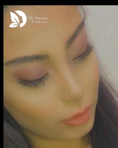 عمل-بینی-611
