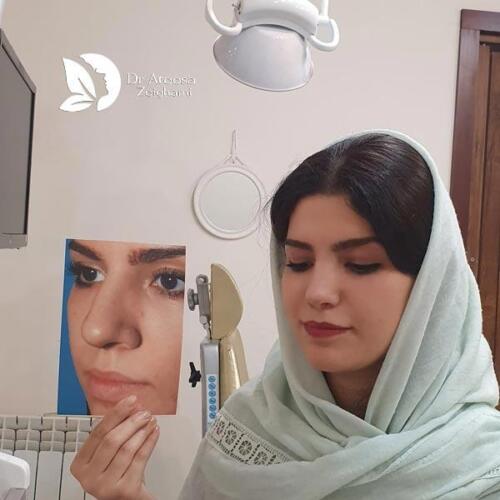 عمل-بینی-616