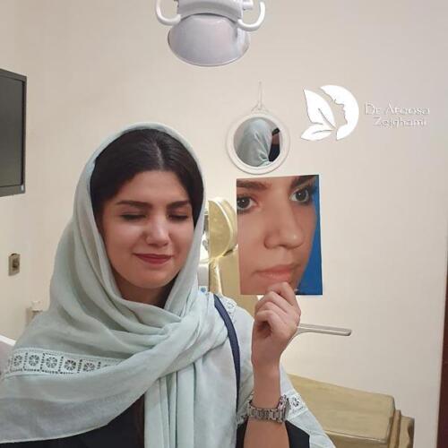 عمل-بینی-618