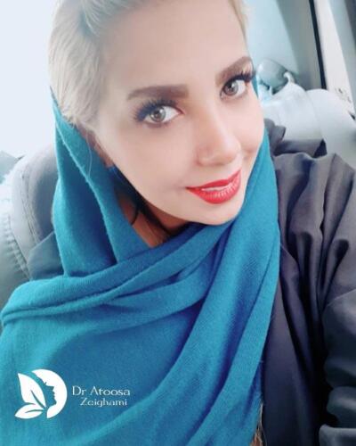 عمل-بینی-620