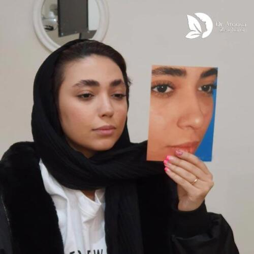 عمل-بینی-621