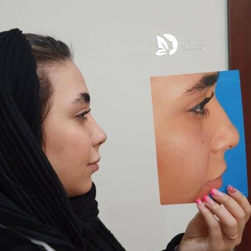 عمل-بینی-622