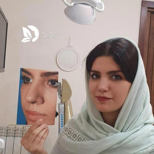 عمل-بینی-630