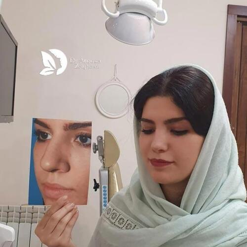 عمل-بینی-631