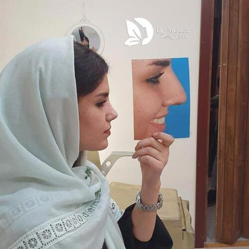 عمل-بینی-635