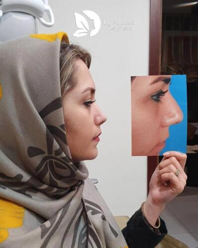 عمل-بینی-637