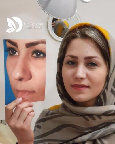 عمل-بینی-638