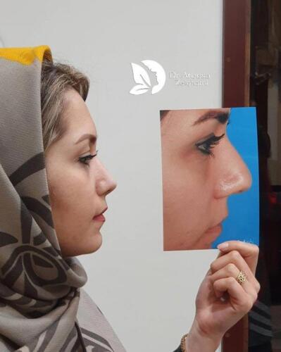 عمل-بینی-639