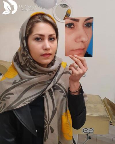 عمل-بینی-641