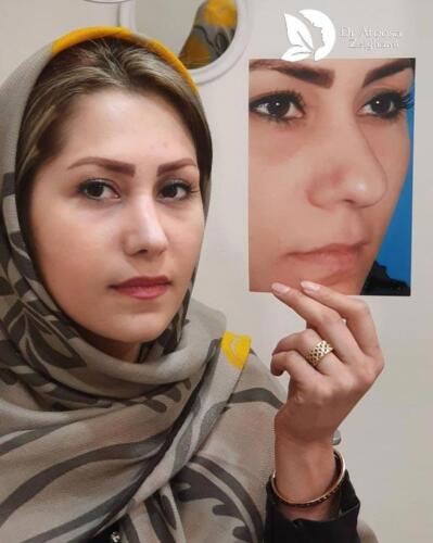 عمل-بینی-642