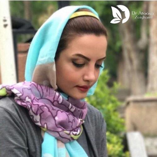 عمل-بینی-647
