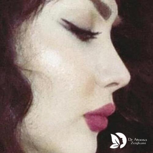عمل-بینی-649