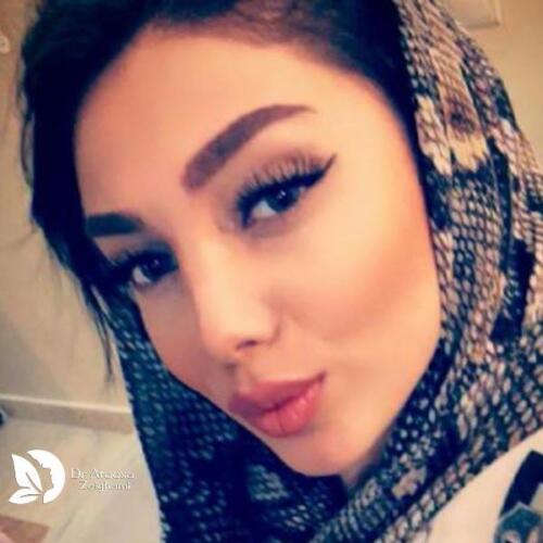 عمل-بینی-657