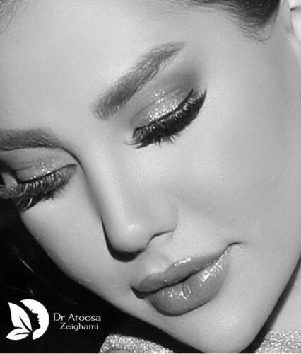عمل-بینی-658