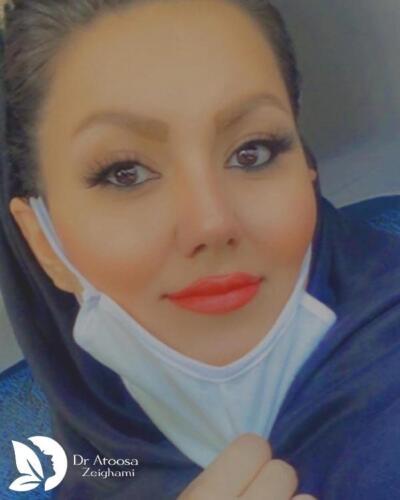 عمل-بینی-672