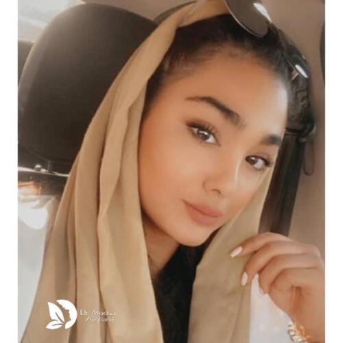 عمل-بینی-678