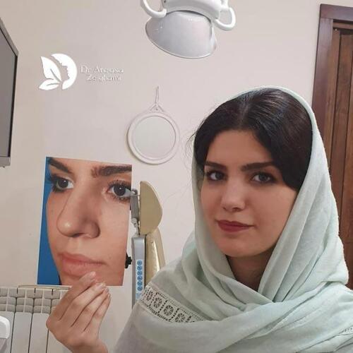 عمل-بینی-702