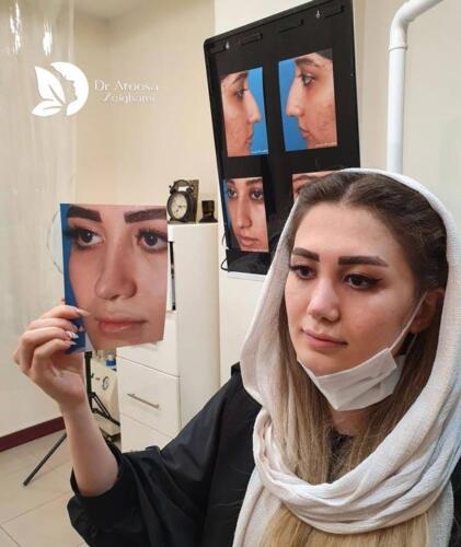 عمل-بینی-709