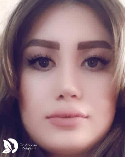 عمل-بینی-716
