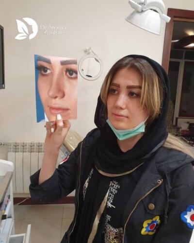 عمل-بینی-721