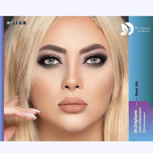 عمل-بینی-738